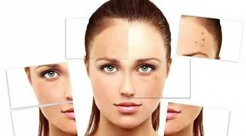 Nguyên nhân gây suy giảm sức khỏe làn da và loạt mẹo phục hồi làn da xấu xí