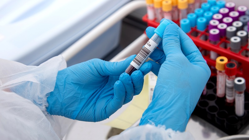 Đột phá y học: Xét nghiệm máu phát hiện UNG THƯ sớm đến 10 năm trước khi có triệu chứng