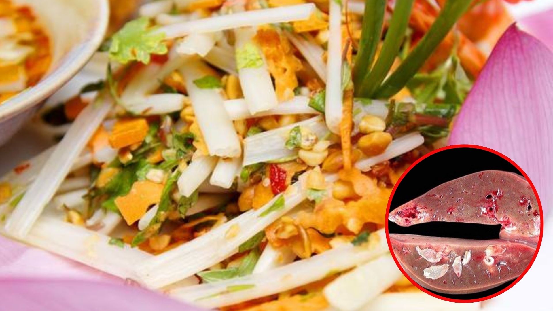 Chủ quán bất ngờ nhận tin gan bị tổn thương nặng vì chính món ăn mình bán mỗi ngày