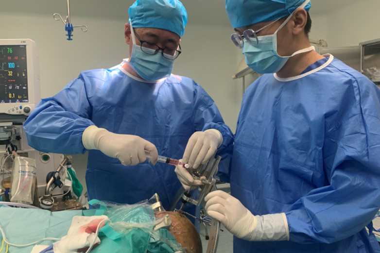 5 dấu hiệu cảnh báo sớm đột quỵ não