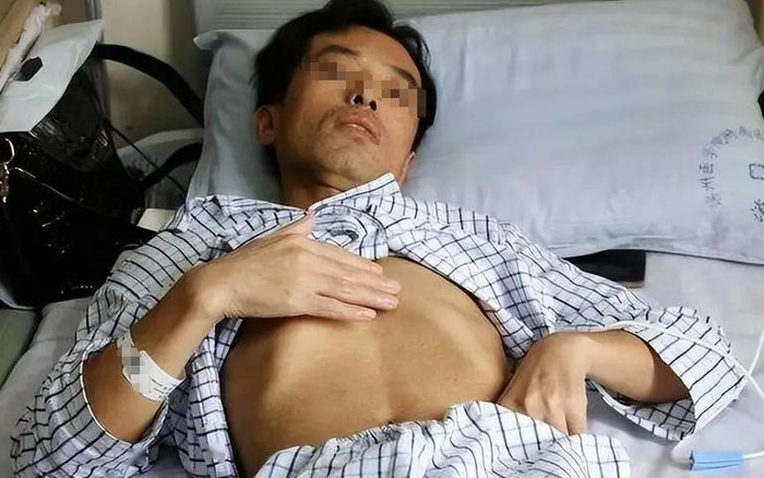 Người đàn ông 53 tuổi mắc ung thư gan, bác sĩ tức giận: Đừng làm việc này quá 3 lần 1 tháng Người đàn ông 53 tuổi mắc ung thư gan, bác sĩ tức giận: Đừng làm việc này quá 3 lần 1 tháng