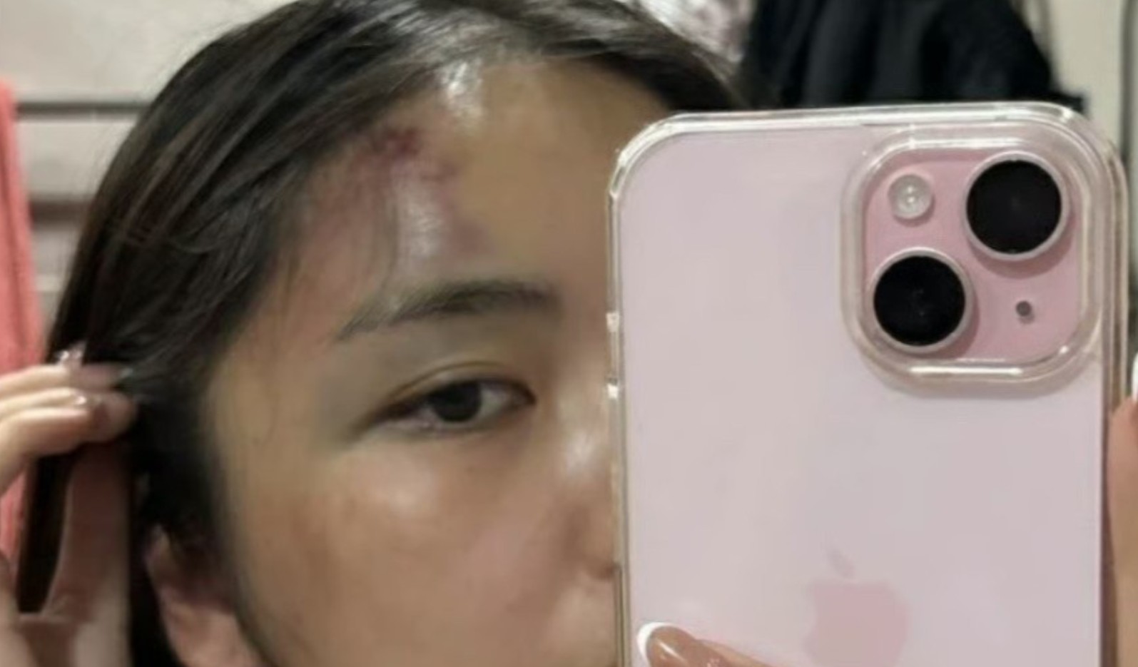 Hà Nội: Chồng đánh vợ thủng màng nhĩ, chấn động não ngay trước mắt hàng xóm