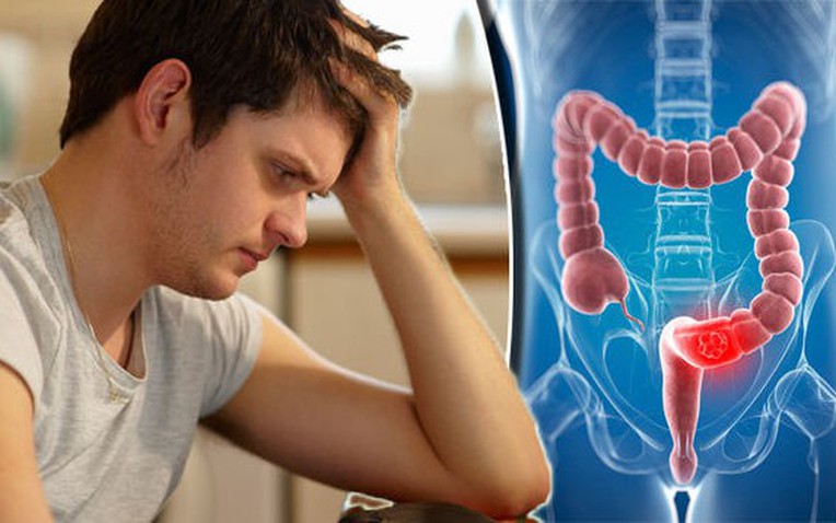 Ngày càng nhiều người trẻ mắc ung thư đại trực tràng, bác sĩ chỉ đích danh 1 triệu chứng rất hay bị bỏ sót