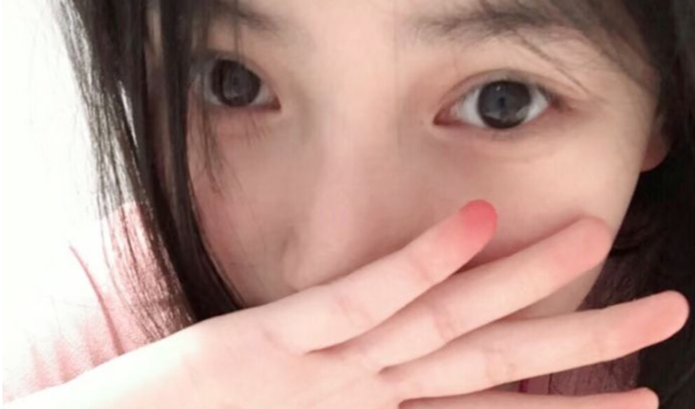 4 kiểu ngáp là tín hiệu cảnh báo đột quỵ, ung thư: Nhiều người ngó lơ rồi hối hận không kịp!