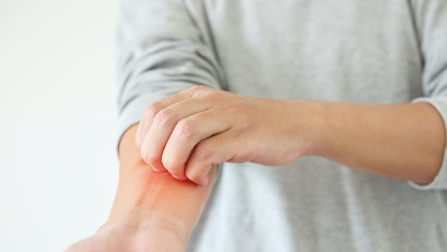 Người đàn ông 40 tuổi phát hiện ung thư gan giai đoạn cuối: Đáng tiếc ông đã bỏ qua dấu hiệu suốt 3 tháng