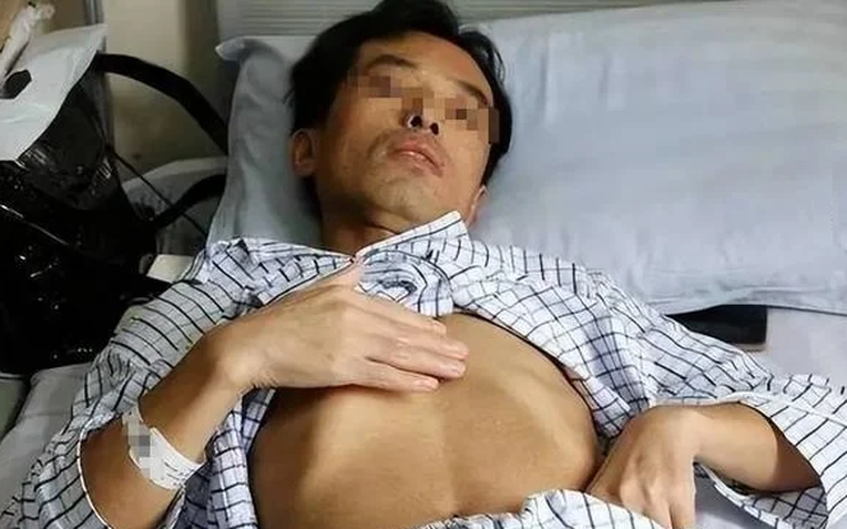 Người đàn ông mắc ung thư gan vì ngày nào cũng uống nước từ loại cốc nhiều người dùng mỗi ngày