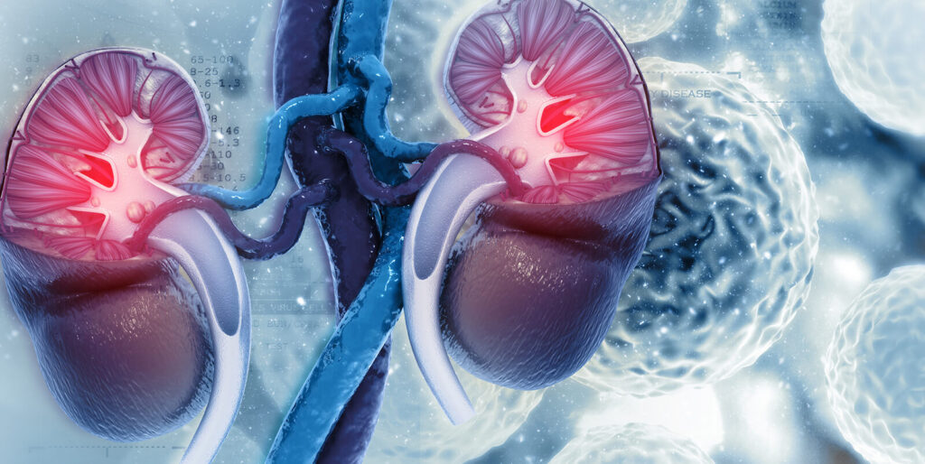 Thận xuống cấp nhanh chóng nếu ăn quá nhiều 9 loại thực phẩm này: Toàn món khoái khẩu của nhiều người