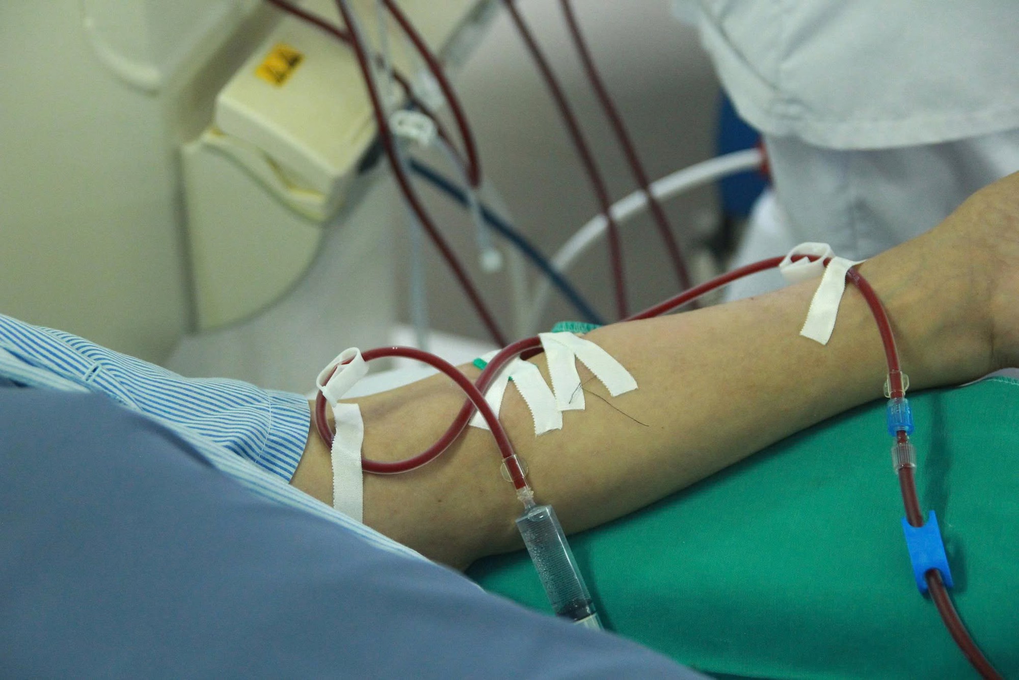 Có dấu hiệu này cần nghĩ tới suy thận